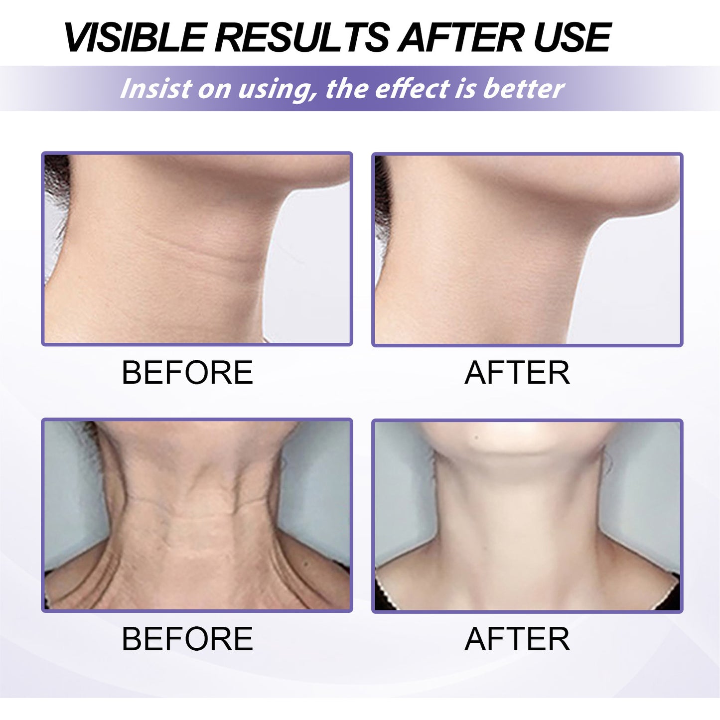 Retinol Neck Cream Neck Massage Desalting Neck Lines Nourishing And Firming Neck Skin Reshaping Swan Neck
