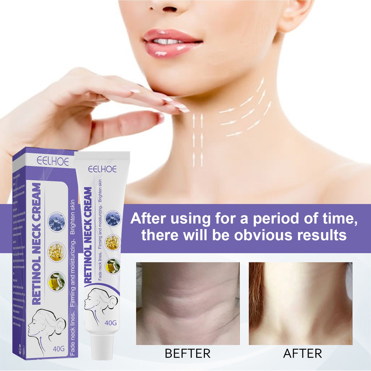 Retinol Neck Cream Neck Massage Desalting Neck Lines Nourishing And Firming Neck Skin Reshaping Swan Neck